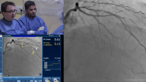 coronary angiogram test